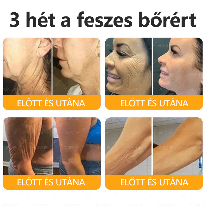 ✨CleraNaure® Méhméreg Bőrregeneráló Krém✨