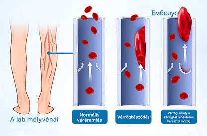 CleraNaure® VeinGuard gyógynövényes permet – Klinikailag igazolt, hogy már 7 nap alatt eltünteti a visszértágulatokat! ⭐️