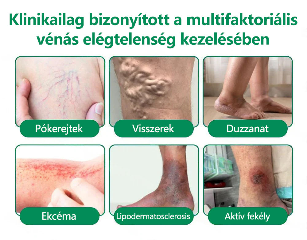CleraNaure® VeinTarget Mikrotűs Pólya 🗽 Azonnali Enyhülés, Hosszú Távú Eredmények