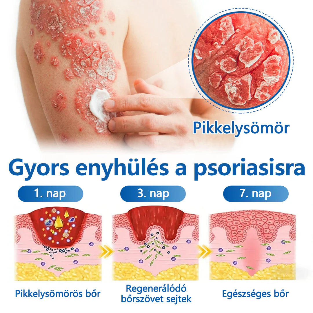 🛡️🛡️CleraNaure® Töredezett Bőrre Helyreállító Krém🛡️🌿 Többfunkciós Regeneráló Zúzódások, Szárazság és Pattanások Ellen