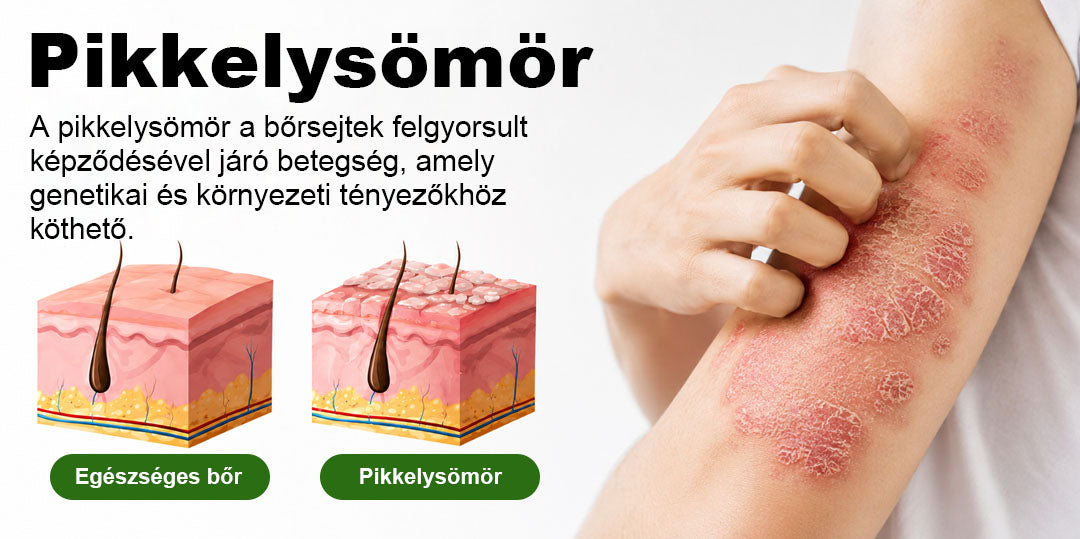 🌿 Timilk® DermaOat növényi bőrbarrier-erősítő krém🌿