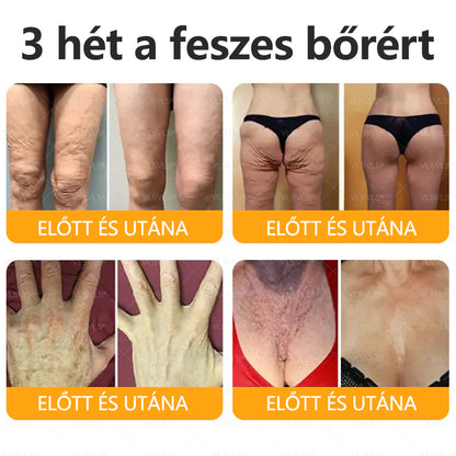 ✨CleraNaure® Méhméreg Bőrregeneráló Krém✨