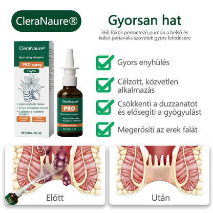 🎁 Időszakos ajánlat | CleraNaure® Gyors Aranyér PRO Spray