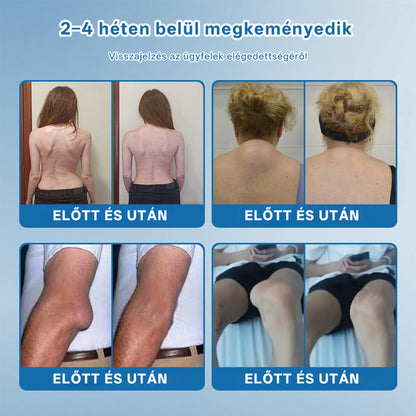 CleraNaure® BPC-157 Ízületjavító Krém 🦴 Kezeli az arthritis-t, neuropátiát, reumát, sport sérüléseket és még sok mást