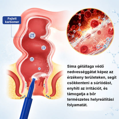 🌿🌿 Timilk® ProctoEase nyugtató aranyérápoló gél