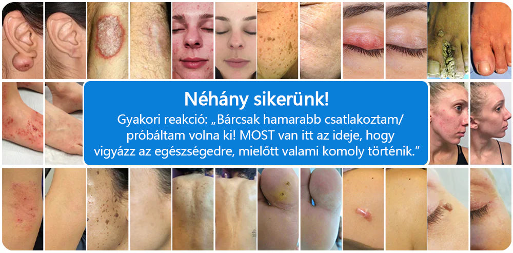 CleraNature® Magnéziumos Spray – Gyors Enyhülés Viszkető, Vörös és Érzékeny Bőrre (Még Intim Területeken is)