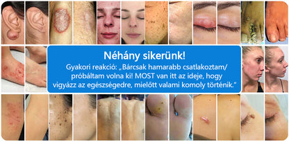 CleraNature® Magnéziumos Spray – Gyors Enyhülés Viszkető, Vörös és Érzékeny Bőrre (Még Intim Területeken is)