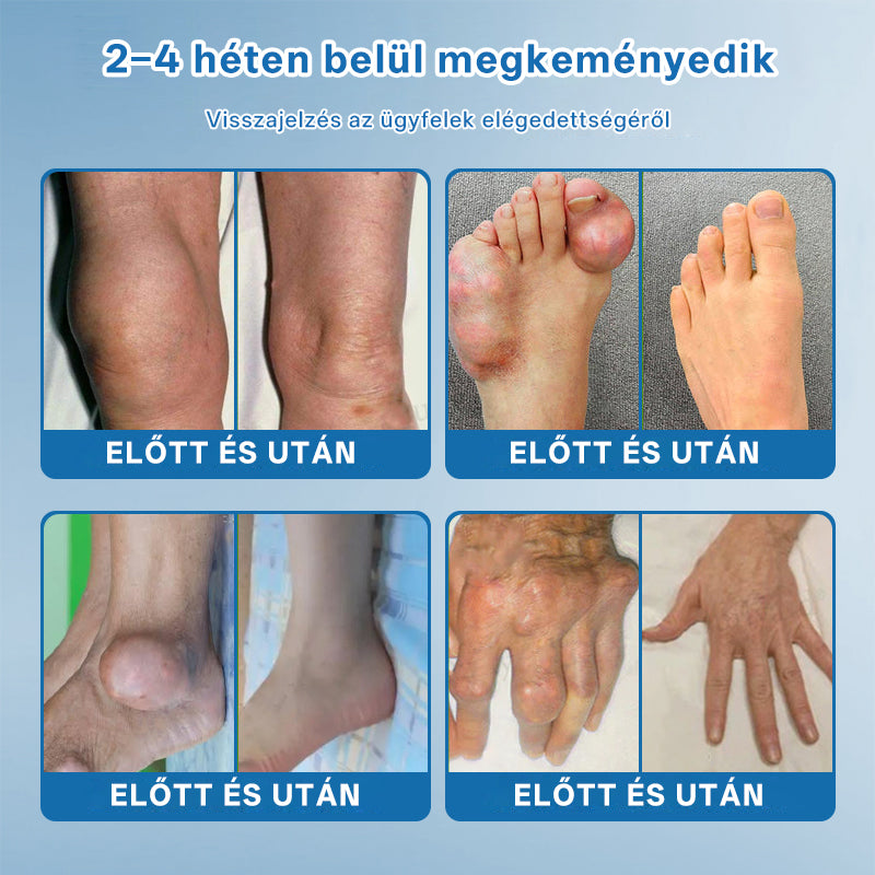 CleraNaure® BPC-157 Ízületjavító Krém 🦴 Kezeli az arthritis-t, neuropátiát, reumát, sport sérüléseket és még sok mást