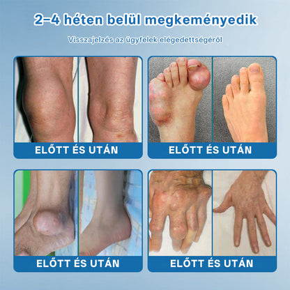 CleraNaure® BPC-157 Ízületjavító Krém 🦴 Kezeli az arthritis-t, neuropátiát, reumát, sport sérüléseket és még sok mást