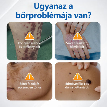 🛡️🛡️CleraNaure® Töredezett Bőrre Helyreállító Krém🛡️🌿 Többfunkciós Regeneráló Zúzódások, Szárazság és Pattanások Ellen