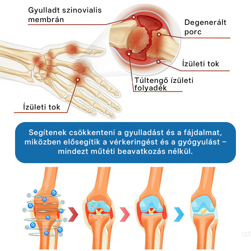 CleraNaure® BPC-157 Ízületjavító Krém 🦴 Kezeli az arthritis-t, neuropátiát, reumát, sport sérüléseket és még sok mást