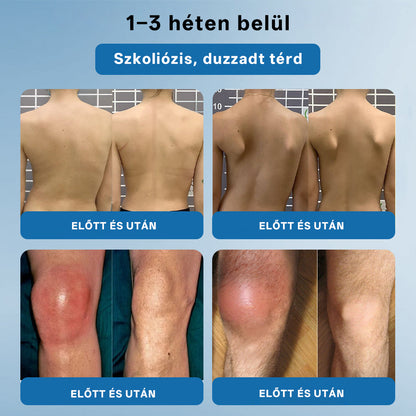 CleraNaure® BPC-157 Ízületjavító Krém 🦴 Kezeli az arthritis-t, neuropátiát, reumát, sport sérüléseket és még sok mást