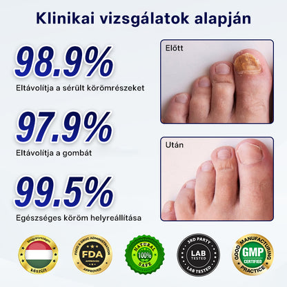 CleraNaure® Gombaellenes Körömjavító Tapasz