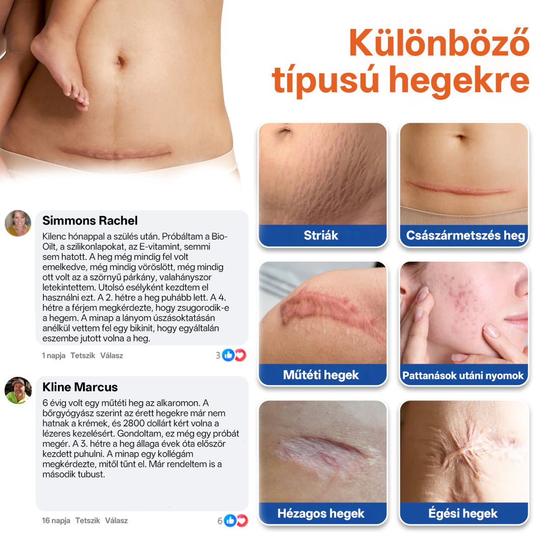 CleraNaure® DermalRebuild Bőrfelújító Gél