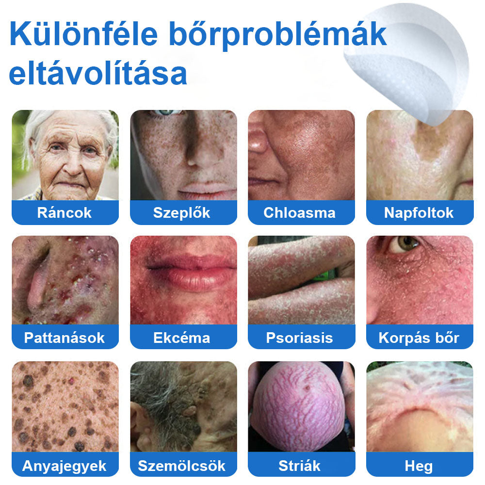 📌 Timilk® 2 az 1-ben mikrotűs és hidrokolloid tapasz | Kiemelkedő anyajegyek, pattanások, lapos szemölcsök és bőrkinövések eltávolítására | Segít javítani a ráncok, hegek és bőrhibák megjelenését | Láthatatlan pattanástapasz arcra és testre📌