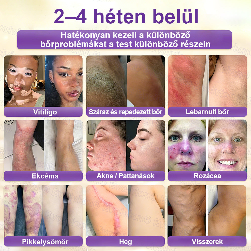 CleraNaure® Biotin 10-in-1 Bőrhelyreállító Krém
