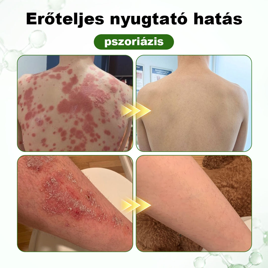 🌿 Timilk® DermaOat növényi bőrbarrier-erősítő krém🌿