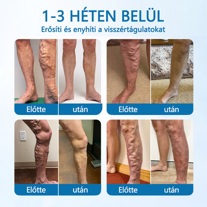 🪶CleraNaure® VeinGuard Gyógynövényes spray – ✅ Klinikailag bizonyított, hogy mindössze 7 nap alatt eltünteti a visszereket!🪶