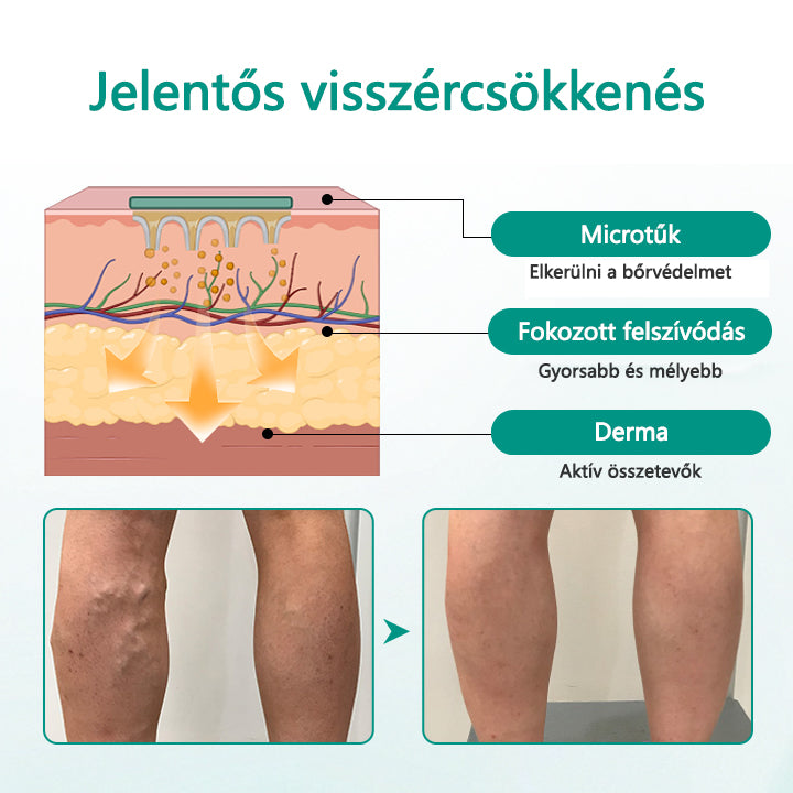 CleraNaure® LegRenew Visszértágulat Párna