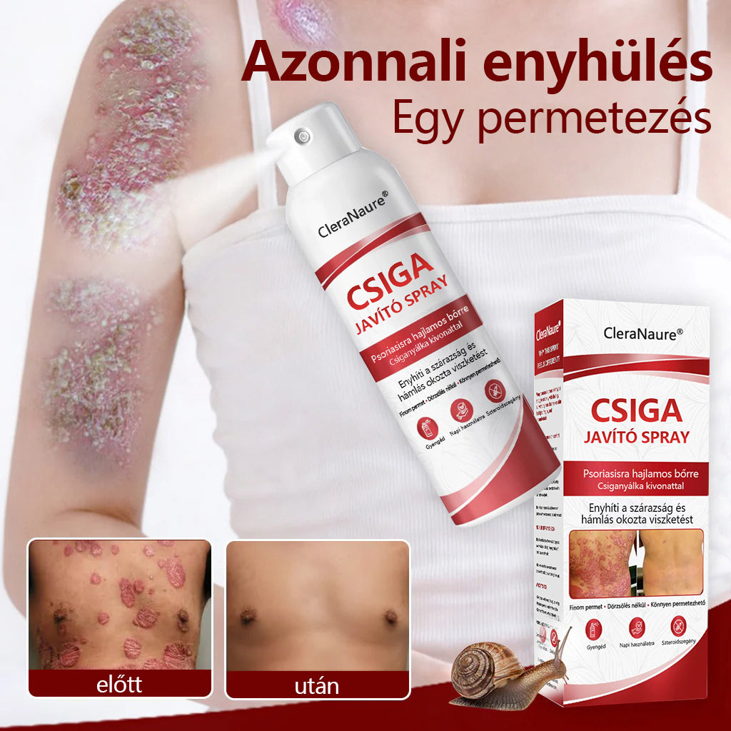 CleraNature® Bálnazsír Spray Viszkető, Hámló Psoriasisra Hajlamos Bőrre