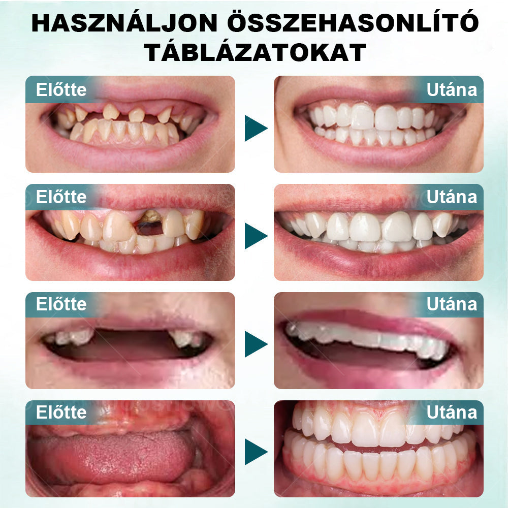 ✅CleraNaure® FirmHold műfogragasztó