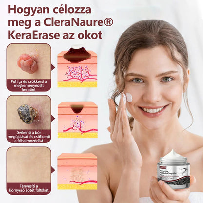 ⭐Hivatalos áruház👨‍⚕️ CleraNaure® KeraErase - Kettős hatású bőrfiatalító krém 👨‍⚕️ (Kettős hatású fiatalítás – simítja a kiemelkedő dudorokat és lebontja a mélyen lerakódott keratint savak és irritáció nélkül