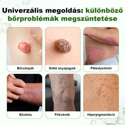 🌿 Timilk® DermaOat növényi bőrbarrier-erősítő krém🌿