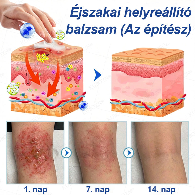 CleraNaure® Ekcéma Nappali és Éjszakai Helyreállító Rendszer – 100%-ban szteroidmentes kettős az intenzív viszketés, bőrpír és sérült bőr enyhítésére (akciós ajánlat)