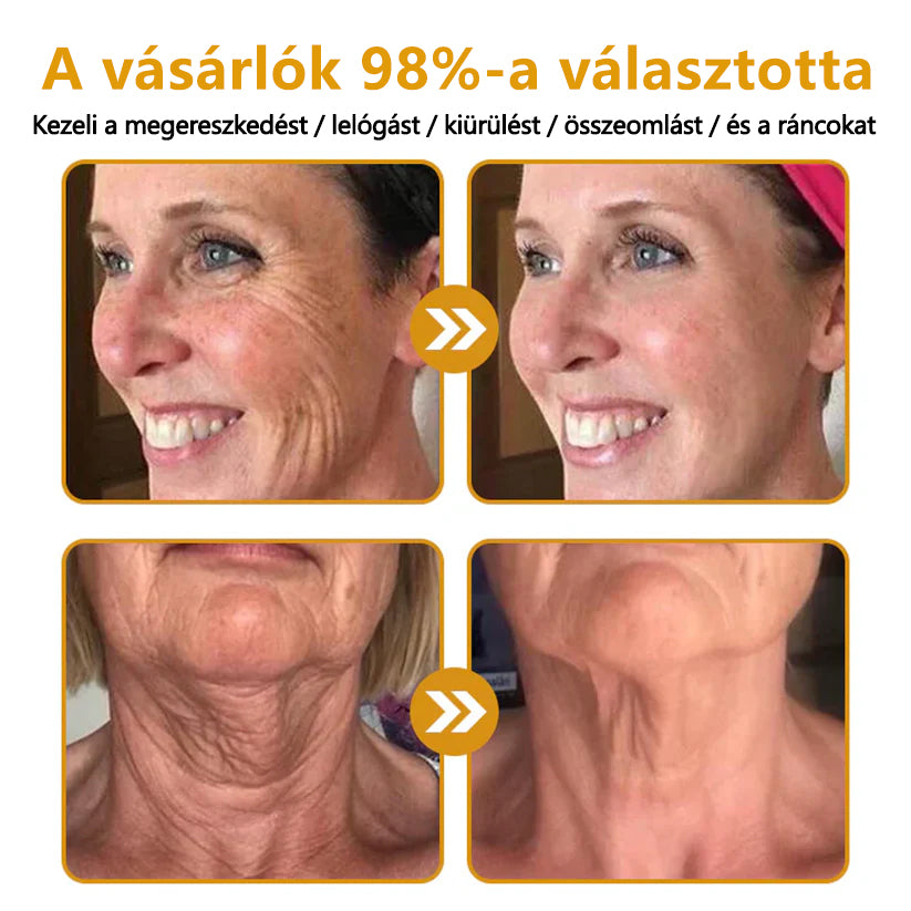 🥇CleraNaure® Méhméreg Bőrregeneráló Krém🫧🫧