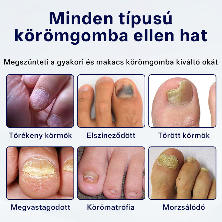 CleraNaure® Gombaellenes Körömjavító Tapasz