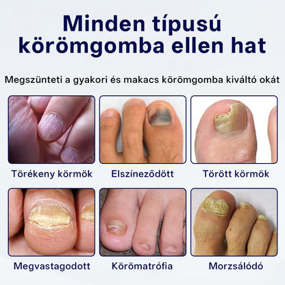CleraNaure® Gombaellenes Körömjavító Tapasz