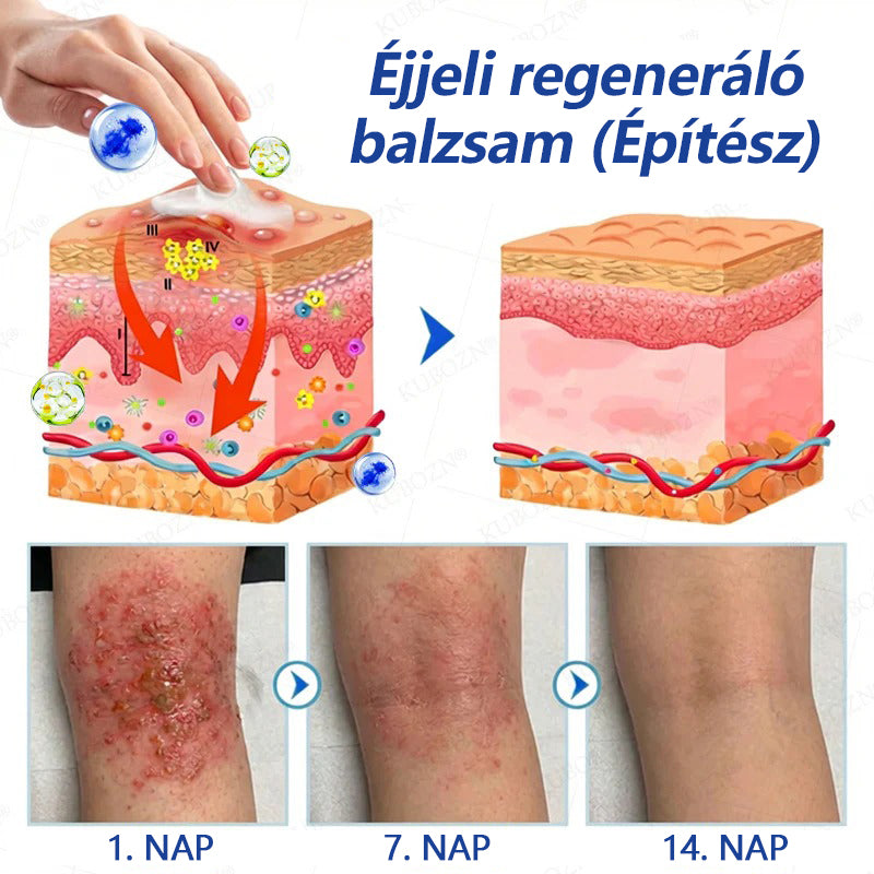 🎖️🎖️CleraNaure® Pikkelysömör Nappali és Éjszakai Helyreállító Rendszer – 100% szteroidmentes kettős készítmény a plakkok, pikkelyesedés és viszketés enyhítésére