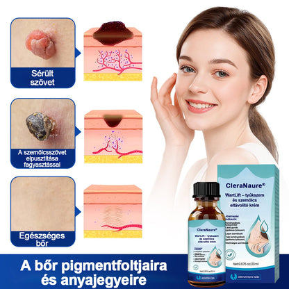 CleraNaure® WartLift tyúkszemeltávolító folyadék