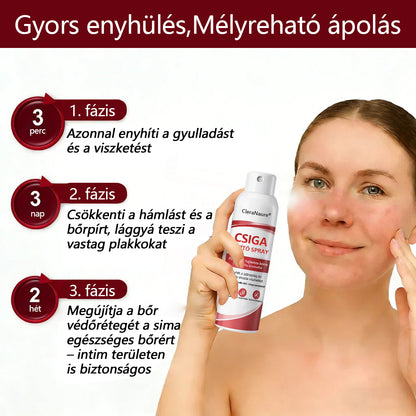 CleraNature® Bálnazsír Spray Viszkető, Hámló Psoriasisra Hajlamos Bőrre