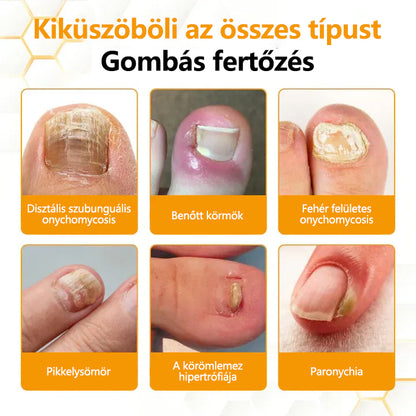 CleraNature® Antifungális Köröm Revitalizáló Olaj Méhméreggel