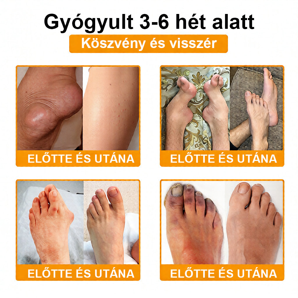 CleraNaure® Méhméreg Fájdalomcsillapító Csontregeneráló Krém (Kifejezetten idősebb felnőttek számára)