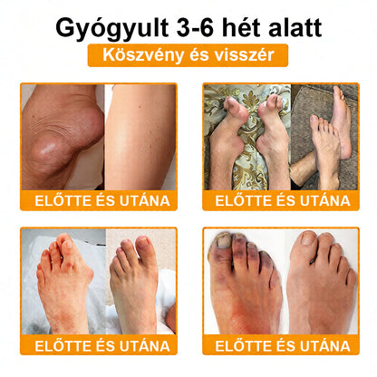 CleraNaure® Méhméreg Fájdalomcsillapító Csontregeneráló Krém (Kifejezetten idősebb felnőttek számára)