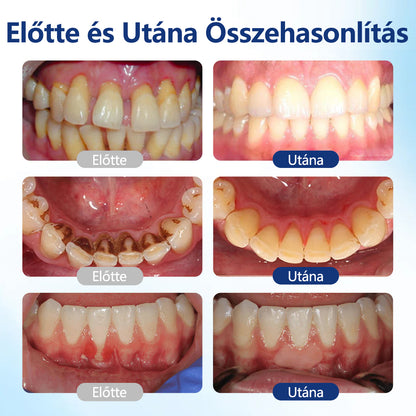CleraNaure® BeeTakt Szájápoló Javító Oldat 🫧