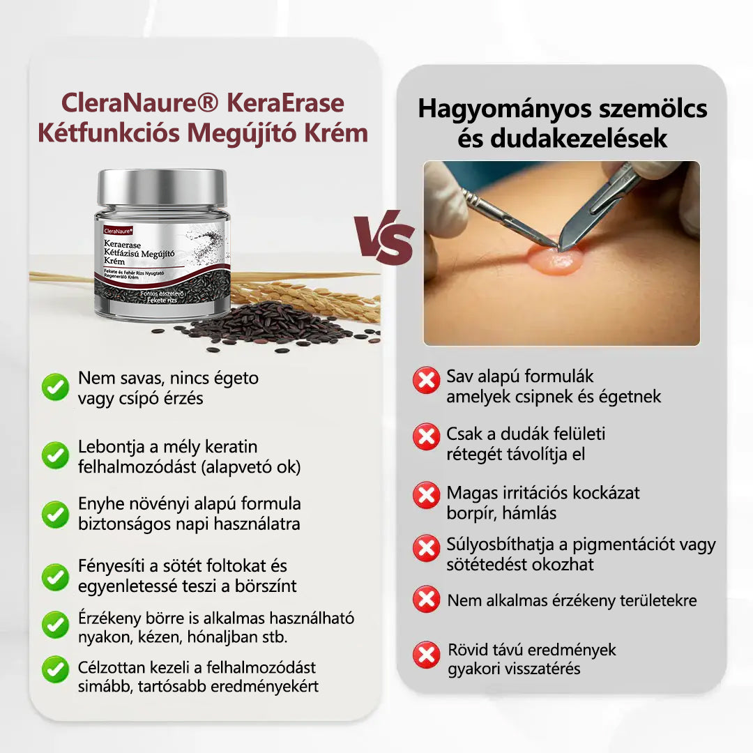 ⭐Hivatalos áruház👨‍⚕️ CleraNaure® KeraErase - Kettős hatású bőrfiatalító krém 👨‍⚕️ (Kettős hatású fiatalítás – simítja a kiemelkedő dudorokat és lebontja a mélyen lerakódott keratint savak és irritáció nélkül