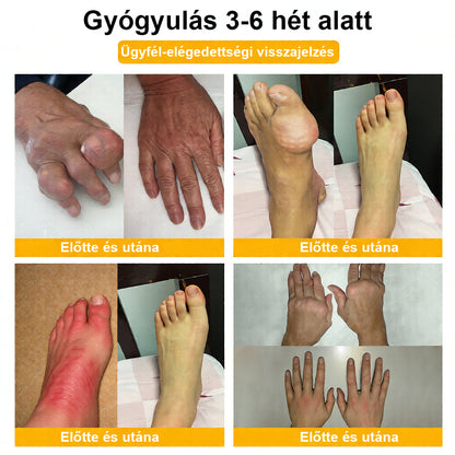 CleraNaure® Méhméreg Fájdalomcsillapító Csontregeneráló Krém (Kifejezetten idősebb felnőttek számára)