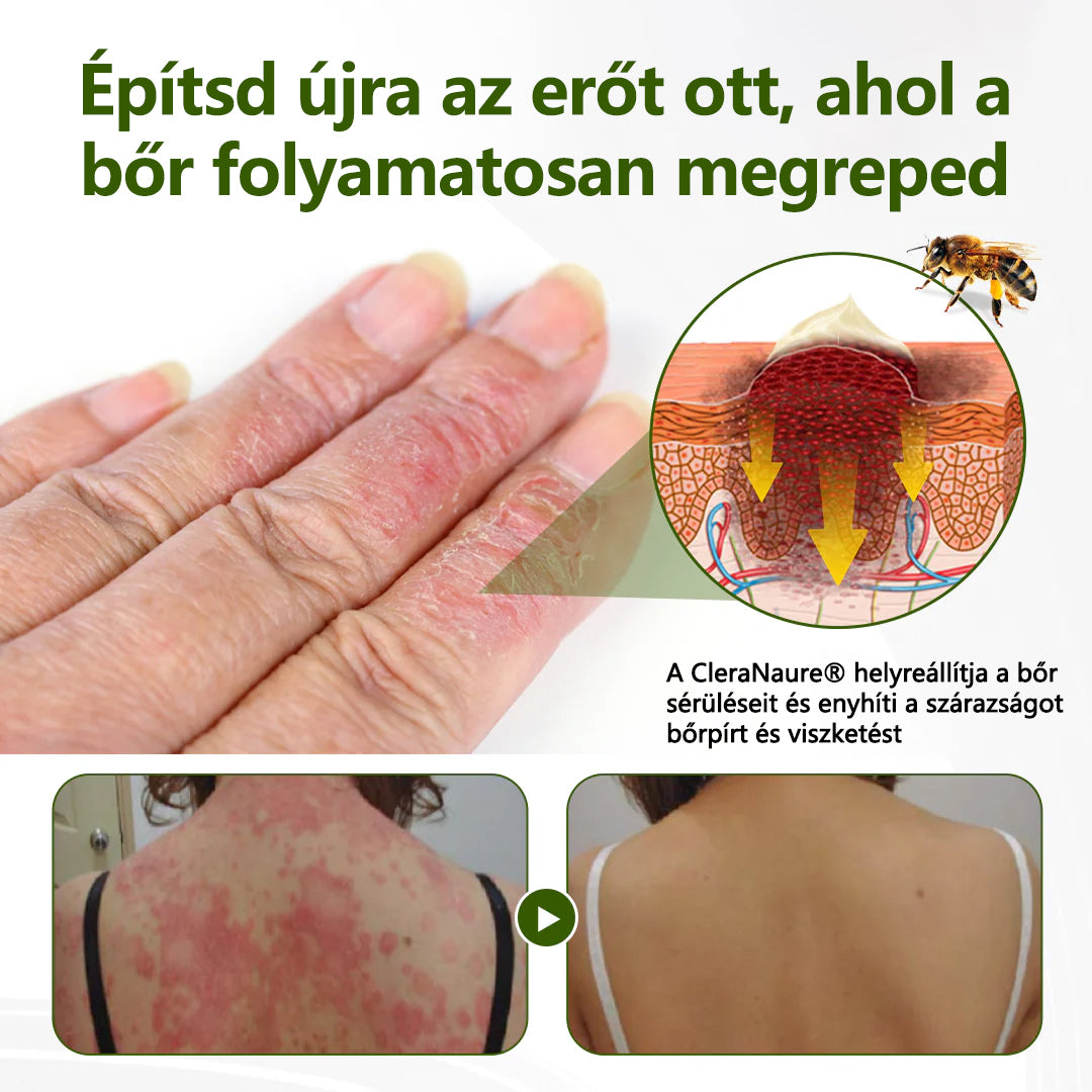 CleraNaure® BeePeptide RootSoft DualRelief krém