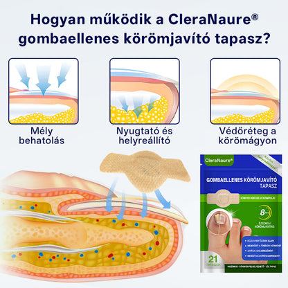 CleraNaure® Gombaellenes Körömjavító Tapasz