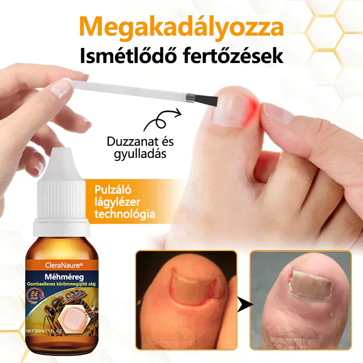 CleraNature® Antifungális Köröm Revitalizáló Olaj Méhméreggel