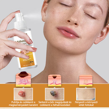 CleraNature® Méhméreg Szemölcs Megújító Spray