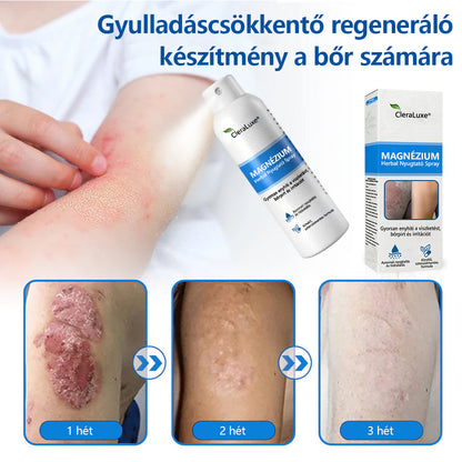 CleraNature® Magnéziumos Spray – Gyors Enyhülés Viszkető, Vörös és Érzékeny Bőrre (Még Intim Területeken is)