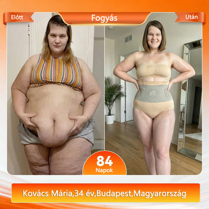 🍃🍃🍃Hivatalos márkabolt | CleraNaure® 2026 Moringa és Berberin 4 az 1-ben mikrorészecskés alakformáló és zsírégető rövidnadrág