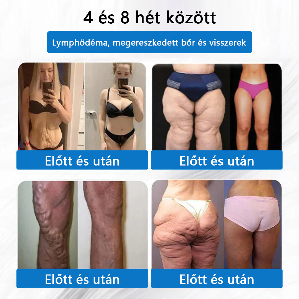 ⭐⭐⭐CleraNaure® 7-v-1 metabolikus és feszesítő tapasz (mikrodifúziós technológia, 24 órás hatás) a testsúly, étvágy, energia és cukoranyagcsere szabályozására 💡