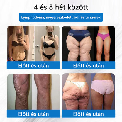 ⭐⭐⭐CleraNaure® 7-v-1 metabolikus és feszesítő tapasz (mikrodifúziós technológia, 24 órás hatás) a testsúly, étvágy, energia és cukoranyagcsere szabályozására 💡