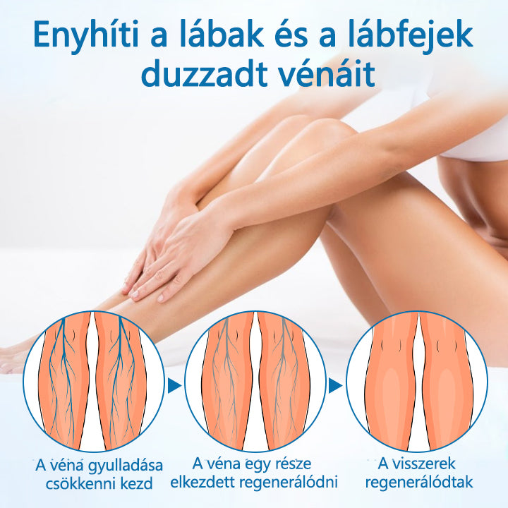 🪶CleraNaure® VeinGuard Gyógynövényes spray – ✅ Klinikailag bizonyított, hogy mindössze 7 nap alatt eltünteti a visszereket!🪶