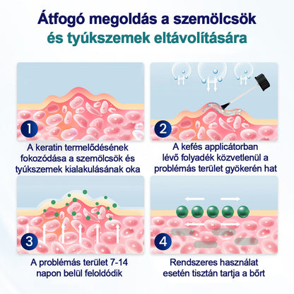 CleraNaure® WartLift tyúkszemeltávolító folyadék